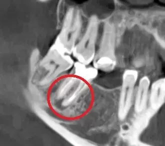 Фото до процедуры