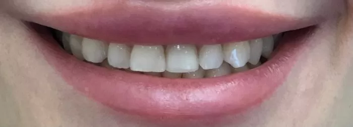 Фото до процедуры