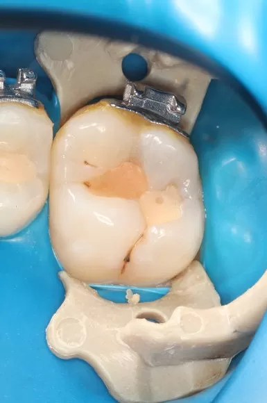 Фото до процедуры