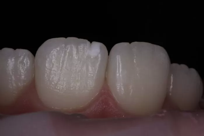 Фото до процедуры