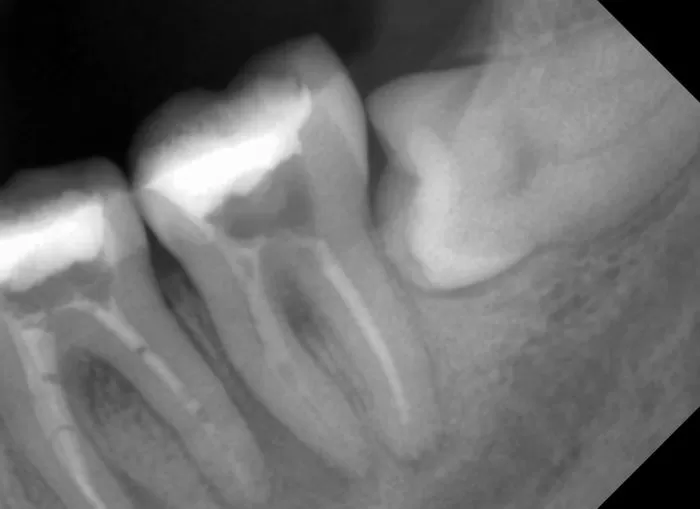 Фото до процедуры